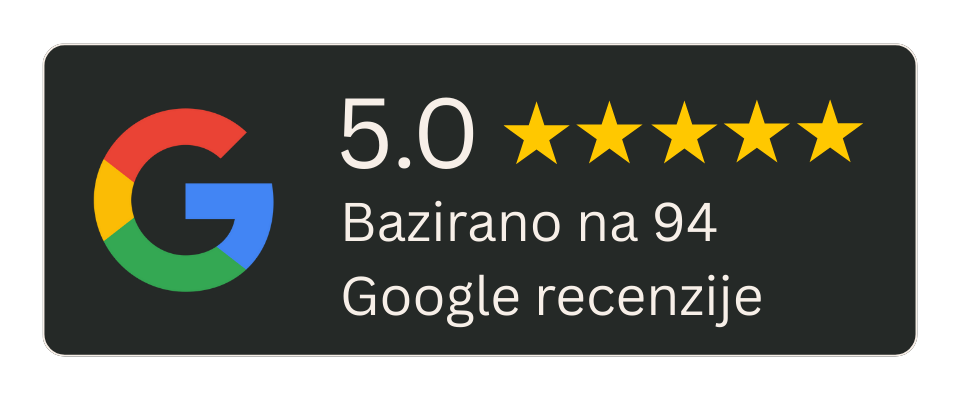 Google recenzije